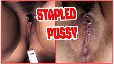 Sadistic doctor closes and staples his patient’s pussy